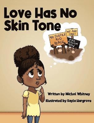 Love Has No Skin Tone 1