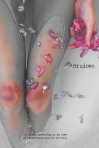 bokomslag Bruises