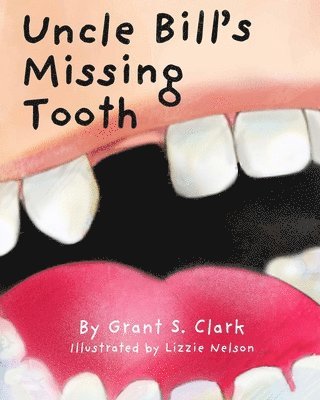 Uncle Bill's Missing Tooth 1