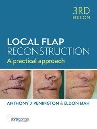 bokomslag Local Flap Reconstruction, 3rd Edition