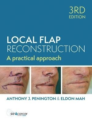 Local Flap Reconstruction, 3rd Edition 1