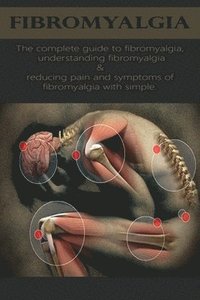 bokomslag Fibromyalgia