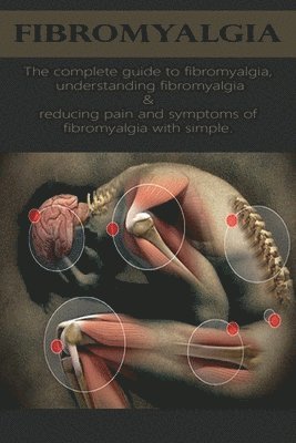 Fibromyalgia 1