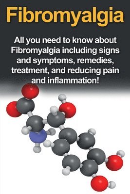 bokomslag Fibromyalgia