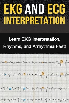 bokomslag EKG and ECG Interpretation