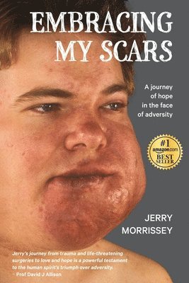 Embracing My Scars 1