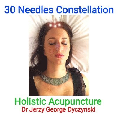 30 Needles Constellation Acupuncture