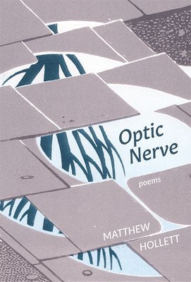 Optic Nerve 1