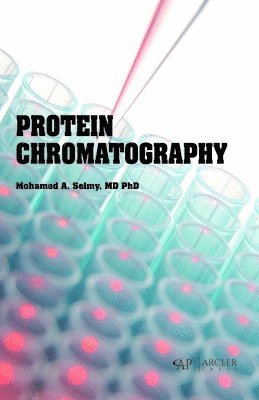 Protein Chromatography 1