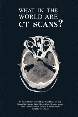 Austin Mardon, Aamna Idrees, Hafsa Idrees - What in the World are CT Scans?, Häftad