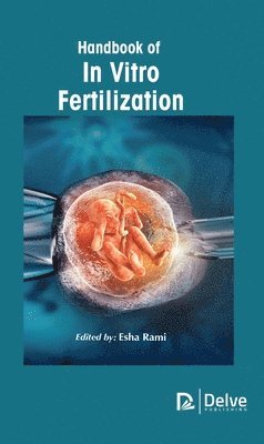 Handbook of In Vitro Fertilization 1