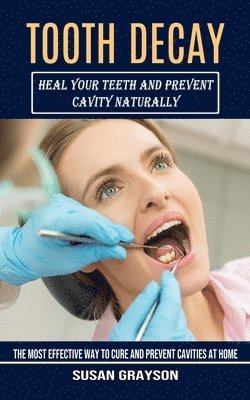 bokomslag Tooth Decay