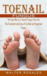 bokomslag Toenail Fungus