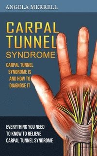 bokomslag Carpal Tunnel Syndrome