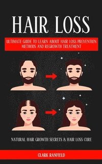 bokomslag Hair Loss