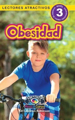 Obesidad