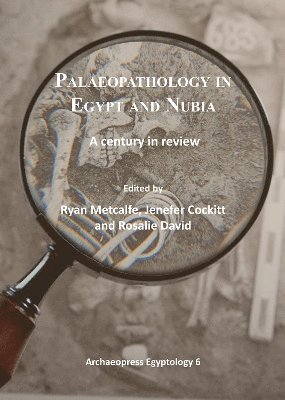 Palaeopathology in Egypt and Nubia 1