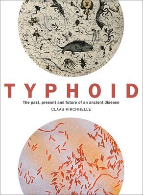 Typhoid 1