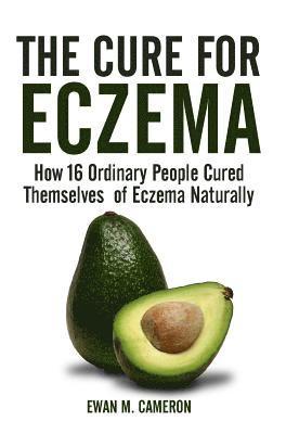bokomslag Cure for Eczema