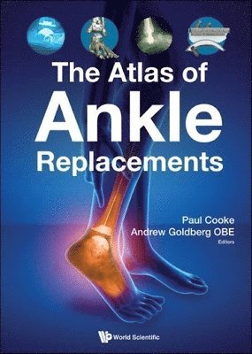 GOLDBERG ANDREW J, Andrew Goldberg, Paul H. Cooke, Andrew J. Goldberg Obe, Andrew J Goldberg Obe, Paul H Cooke - Atlas Of Ankle Replacements, The, Inbunden