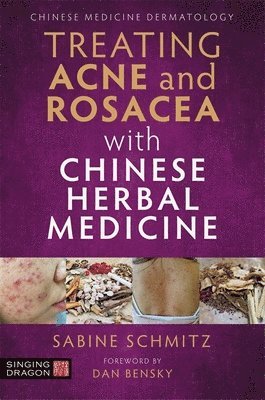 Treating Acne and Rosacea with Chinese Herbal Medicine 1