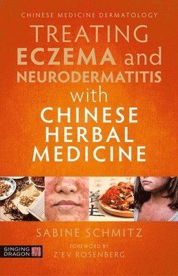 Sabine Schmitz - Treating Eczema and Neurodermatitis with Chinese Herbal Medicine, Häftad