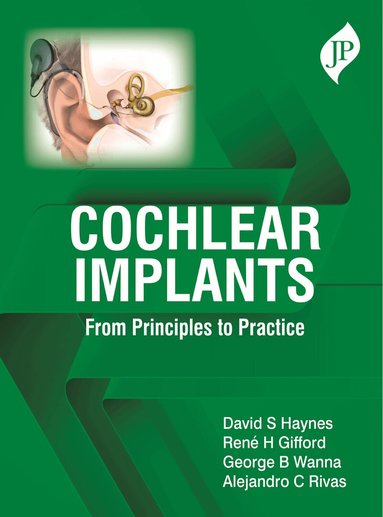 David S Haynes, René H Gifford, George B Wanna, Alejandro C Rivas - Cochlear Implants, Häftad