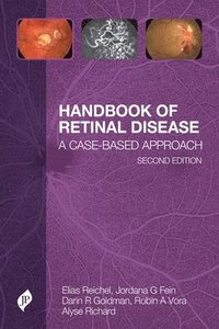 bokomslag Handbook of Retinal Disease