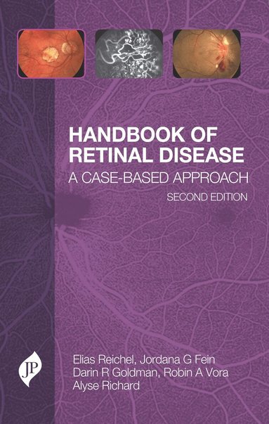 Elias Reichel, Jordana G Fein, Darin R Goldman, Robin A Vora, Alyse Richard - Handbook of Retinal Disease, Häftad