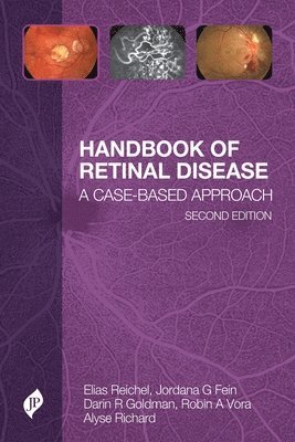 Handbook of Retinal Disease 1