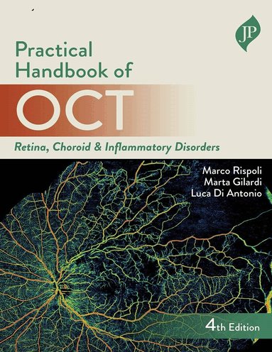 Marco Rispoli, Marta Gilardi, Luca Di Antonio - Practical Handbook of OCT, Inbunden