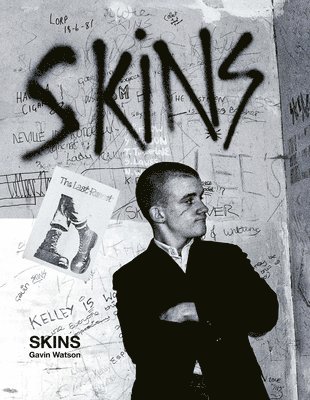 Skins - Special Edition