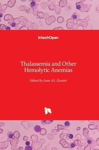 bokomslag Thalassemia and Other Hemolytic Anemias