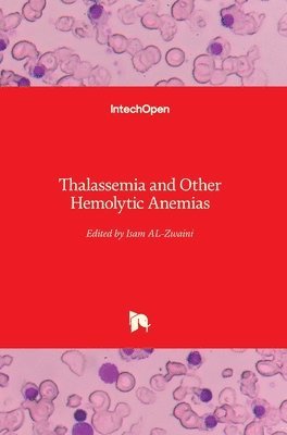 Thalassemia and Other Hemolytic Anemias 1