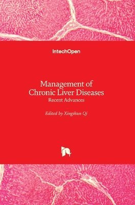 Xingshun Qi - Management of Chronic Liver Diseases, Inbunden