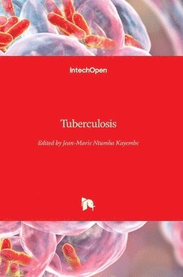 bokomslag Tuberculosis