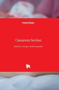 bokomslag Caesarean Section