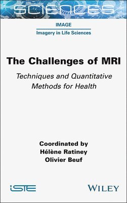 bokomslag The Challenges of MRI