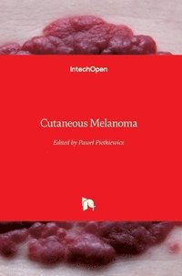 bokomslag Cutaneous Melanoma