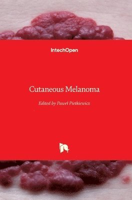 Paweł Pietkiewicz - Cutaneous Melanoma, Inbunden