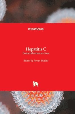 Imran Shahid - Hepatitis C, Inbunden