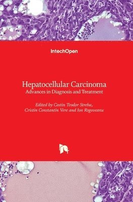 Costin Teodor Streba, Cristin Constantin Vere, Ion Rogoveanu - Hepatocellular Carcinoma, Inbunden