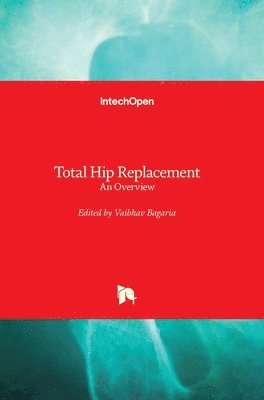 bokomslag Total Hip Replacement