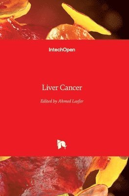 Ahmed Lasfar - Liver Cancer, Inbunden