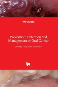 bokomslag Prevention, Detection and Management of Oral Cancer
