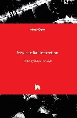 Myocardial Infarction 1