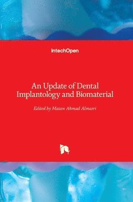 Mazen Ahmad Almasri - Update of Dental Implantology and Biomaterial, Inbunden