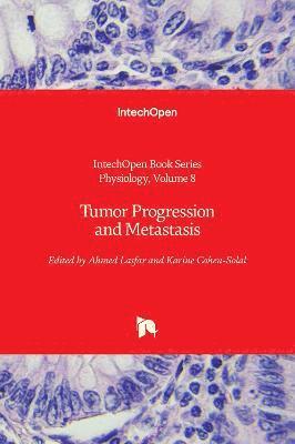 bokomslag Tumor Progression and Metastasis