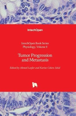 Ahmed Lasfar, Karine Cohen-Solal, Angel Catala - Tumor Progression and Metastasis, Inbunden