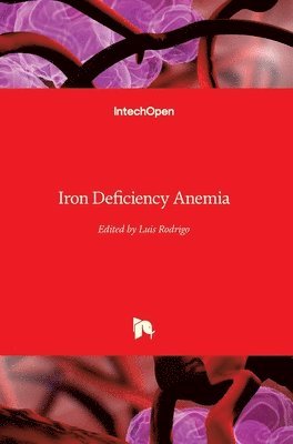 Luis Rodrigo - Iron Deficiency Anemia, Inbunden